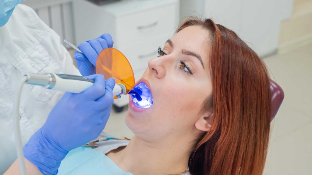Can you drink coffee after a composite filling.